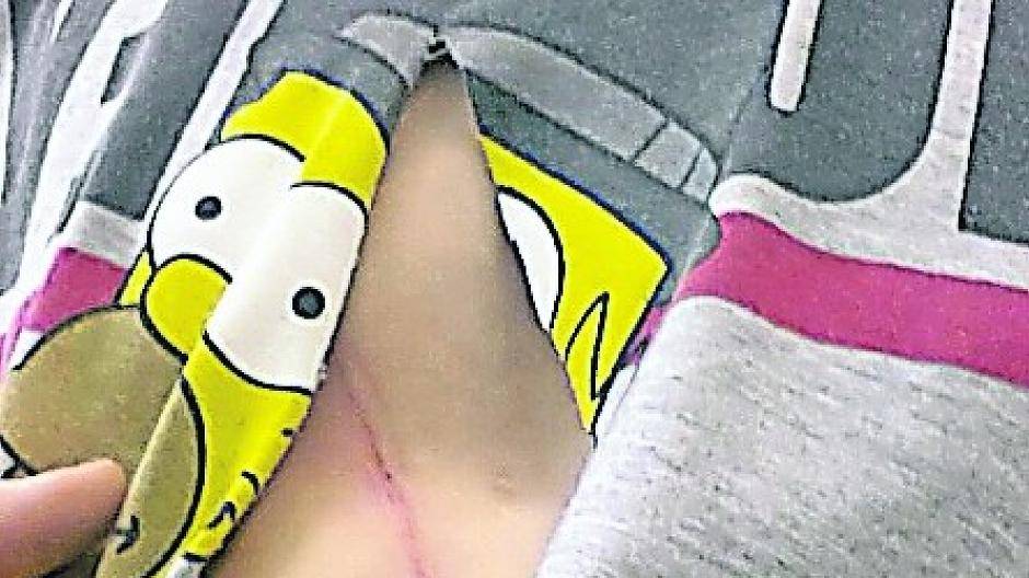 Weil er ein Mädchen beschützen wollte: 16-jähriger Neusser mit Messer attackiert