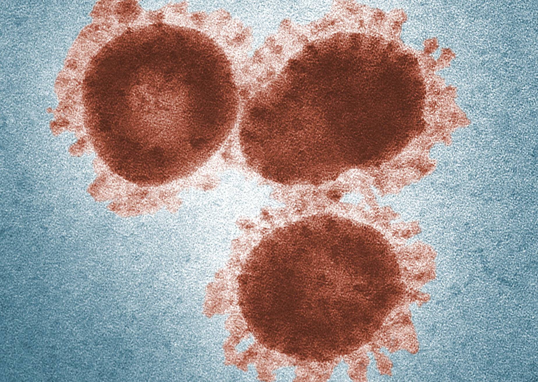 So sieht das so genannte Coronavirus 2019-nCoV aus, das derzeit für Aufregung sorgt. 
